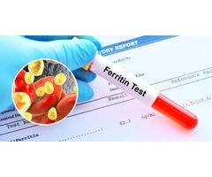 Private Ferritin Blood Test UK | Fast Results | Private Medical Clinic