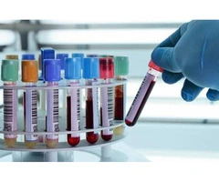 Abnormal Blood Test Results? Get Expert GP Advice | Private Medical Clinic UK