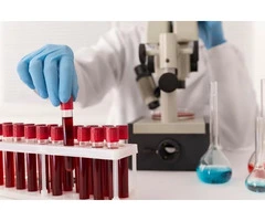 MCV Blood Test UK – Fast Results & GP Review by Private Medical Clinic