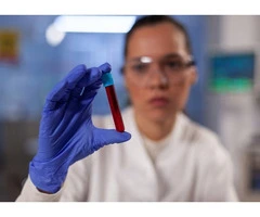 Book a Private RDW Blood Test | Same-Day Appointments At Private Medical Clinic