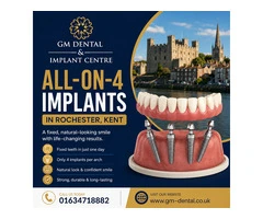 What Is the Cost of All-on-4 Implants in Rochester, Kent?