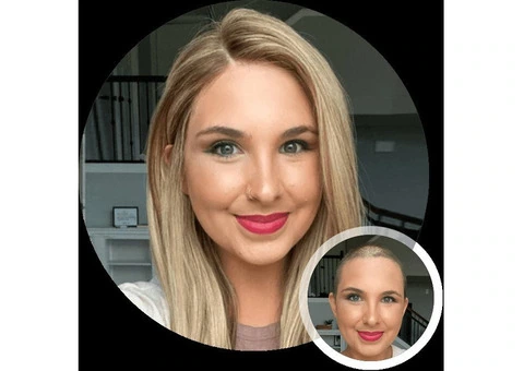 Hair Replacement Systems for Women in London | Oxea London
