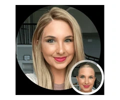 Hair Replacement Systems for Women in London | Oxea London