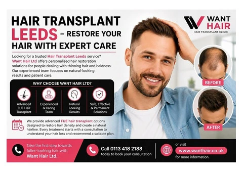 Hair Transplant Leeds - Restore Your Hair With Expert Care