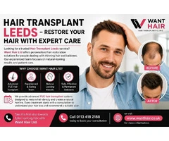 Hair Transplant Leeds - Restore Your Hair With Expert Care