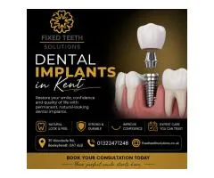 Dental Implants in Kent – Restore Your Smile | Fixed Teeth Solutions