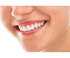 SE19 Dentist – Your Ultimate Teeth Whitening and Invisalign Destination