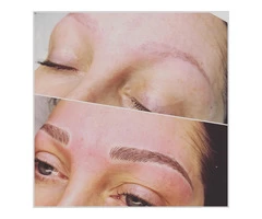 Eyebrows Microblading Treatment in London