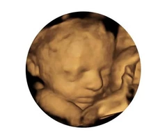 Affordable private ultrasound scan clinic in Milton Keynes.