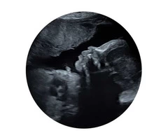 Looking for an affordable private ultrasound scan clinic in reading?