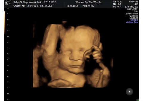 Get a fetal well-being scan in reading from the Window to the Womb.