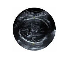 Avail the growth scan in Milton Keynes from the window to the womb.