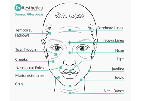Dermal Fillers Birmingham: Enhance Your Natural Beauty