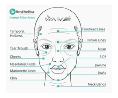 Dermal Fillers Birmingham: Enhance Your Natural Beauty