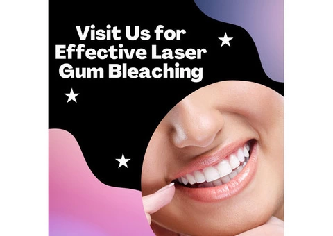 Visit Us for Effective Laser Gum Bleaching