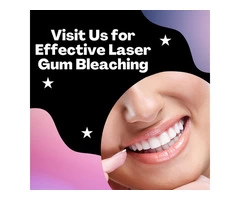 Visit Us for Effective Laser Gum Bleaching