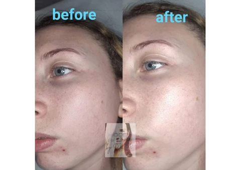 microblading/machine brow /dermaplaning/eyelashes - 2/4