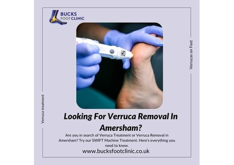 Looking For Verruca Removal in Amersham Try SWIFT Machine Treatment