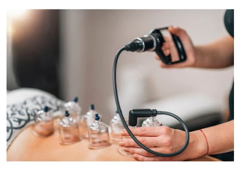 Best Hijama Therapy in Coventry