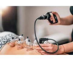 Best Hijama Therapy in Coventry