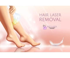 Can laser hair removal be performed on scarred areas?