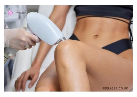What Is The Definition Of Laser Hair Removal Treatment Harrow?