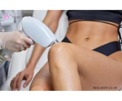 What Is The Definition Of Laser Hair Removal Treatment Harrow?