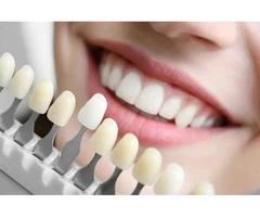 Shine your teeth today with whitening treatment