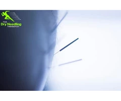 Get Back on the Move with The Dry Needling Therapist