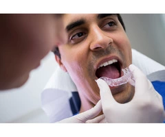 Things To Know Before Undergoing Invisalign Treatment