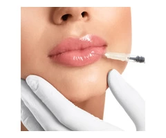 Facial Beauty Solutions | Dermal Fillers | Profhilo | PDO Thread Lift | Fat Melting in High Wycombe