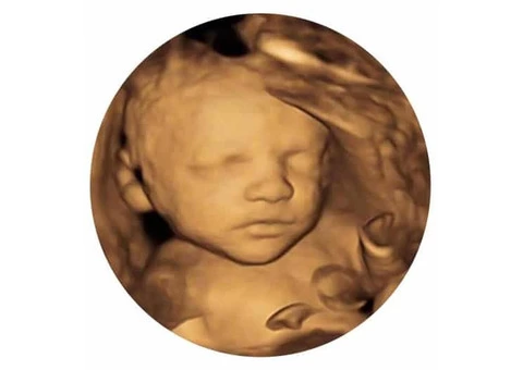 Check your baby’s health from the best fetal well being scan clinic in Milton Keynes.