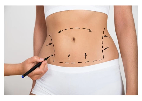 Want Surgery: Leading Plastic Surgery Company in Turkey - 5/6