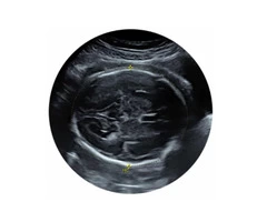Avail the growth scan service in reading from the Window to the Womb.
