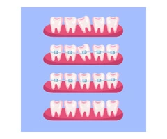 Orthodontics: The Different Types Of Orthodontic Treatment