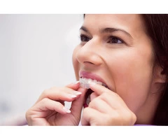 Clinical Effectiveness of Invisalign Treatment in South East London