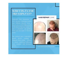 Hair Repair Clinic UK