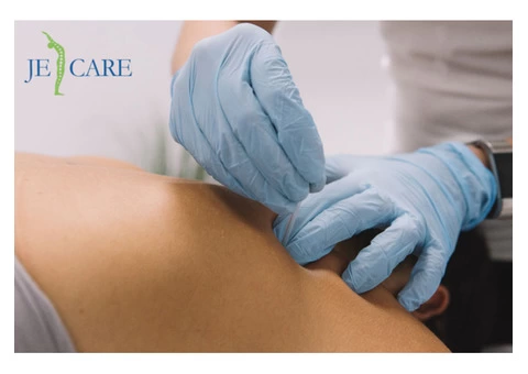 Get Relief from Pain with Dry Needling Therapy