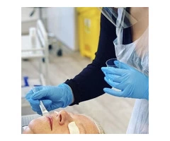 Peeling Treatment in Chester