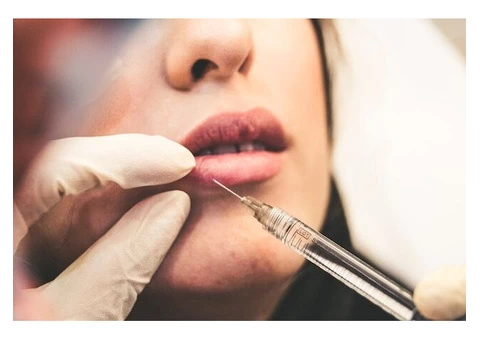 Lip Fillers Cardiff