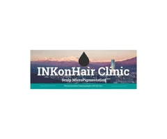 Laser tattoo removal bristol