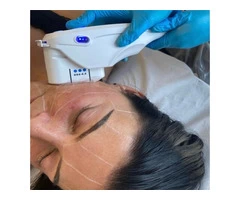 Skin Care Treatment in Chester