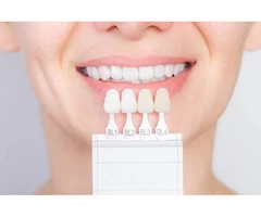 Affordable Dental Implant Cost in Surrey