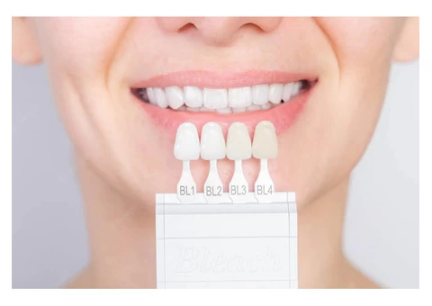 Get Competitive Dental Implant Cost in Surrey