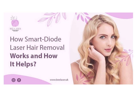 How Smart-Diode Laser Hair Removal Works and How It Helps?
