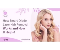 How Smart-Diode Laser Hair Removal Works and How It Helps?