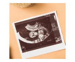 Private Ultrasound Scans In Cardiff - Window to the Womb