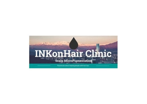 Tattoo Laser Removal in Bristol: Erase Your Ink Regrets Safely and Effectively