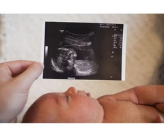 Experience the joy of seeing your baby with a Private 4D Ultrasound Scan