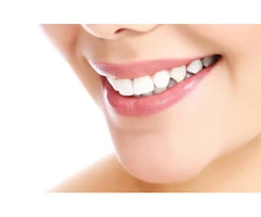 Dental veneers for badly stained teeth